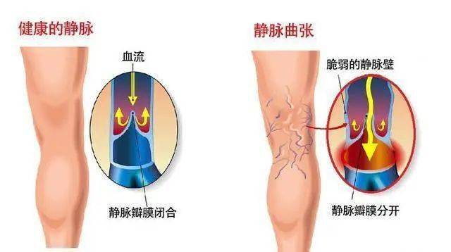 旅行者的足部保健指南，避免脚部疲劳与脚臭的实用建议