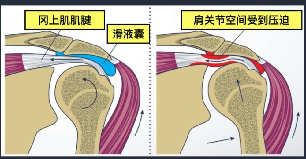 突发跌倒导致的头部损伤应对指南