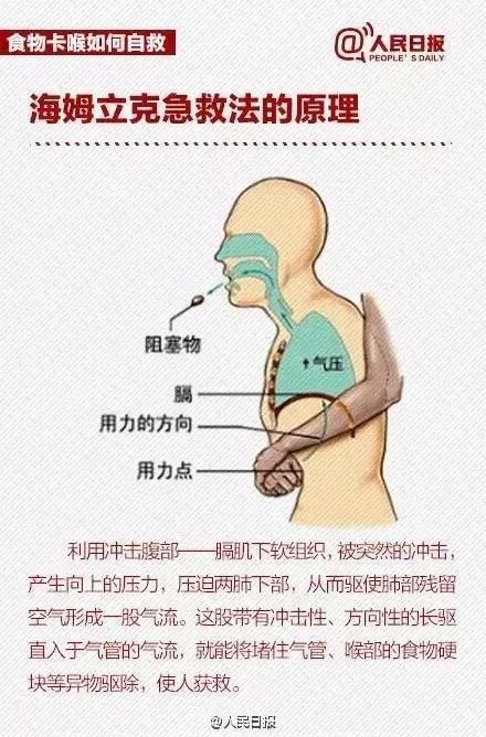 婴幼儿窒息急救方法与注意事项指南