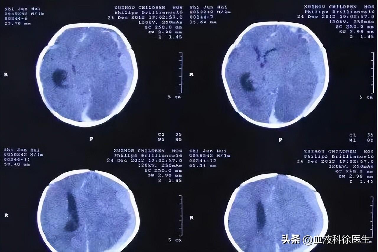 交通事故后的家庭急救处理指南